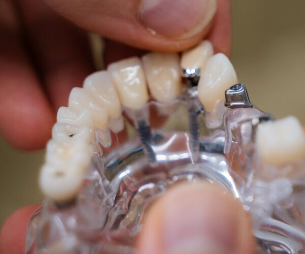 DSC00922-e1697579873155